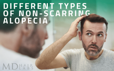 Different Types of Non-Scarring Alopecia