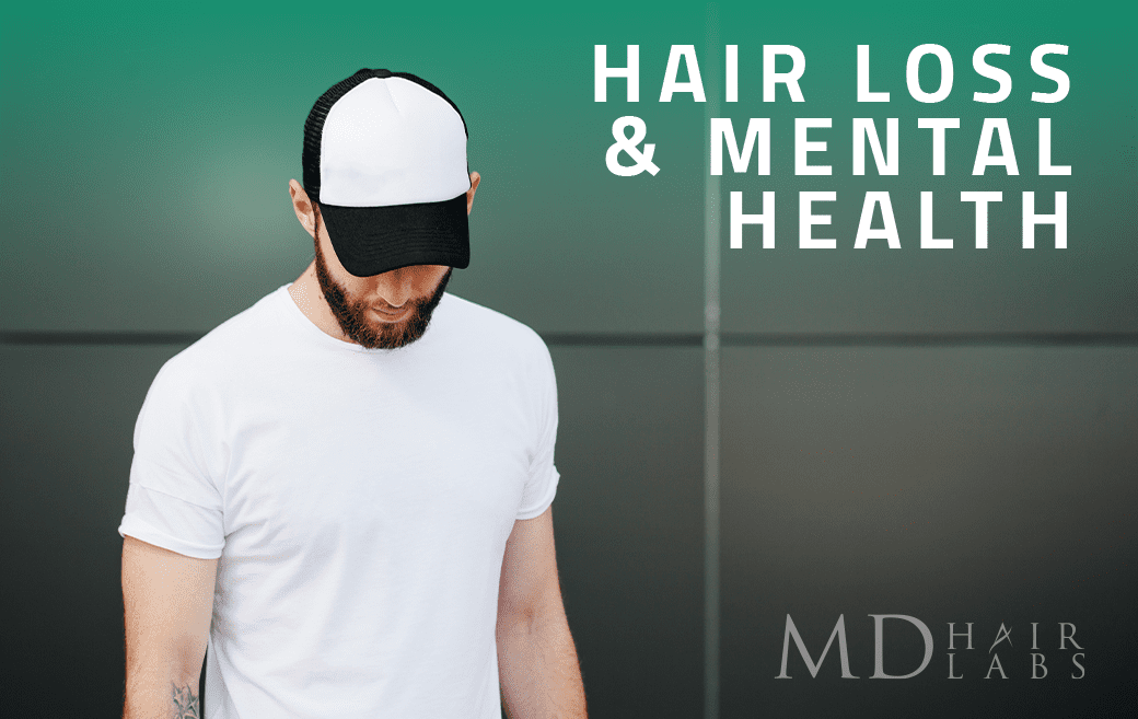 Hair Loss and Mental Health
