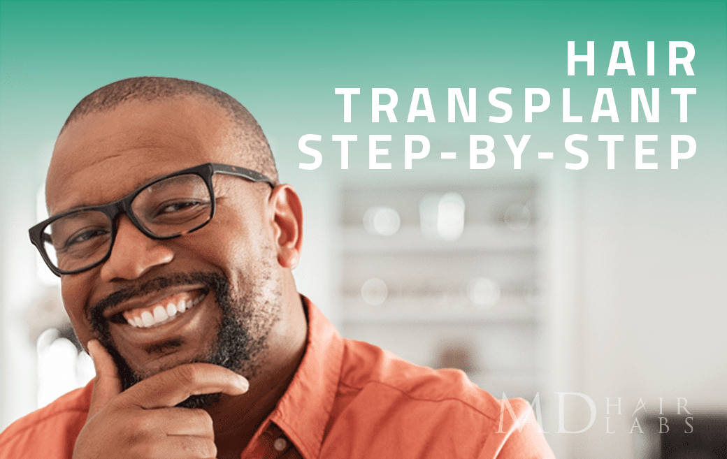Hair Transplant: Step-by-Step