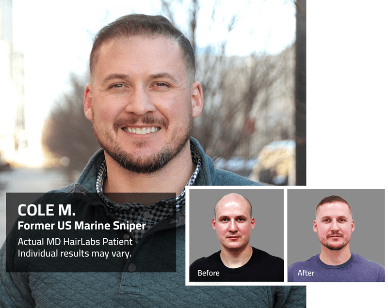 MD-Hair-Home-Slider-Cole