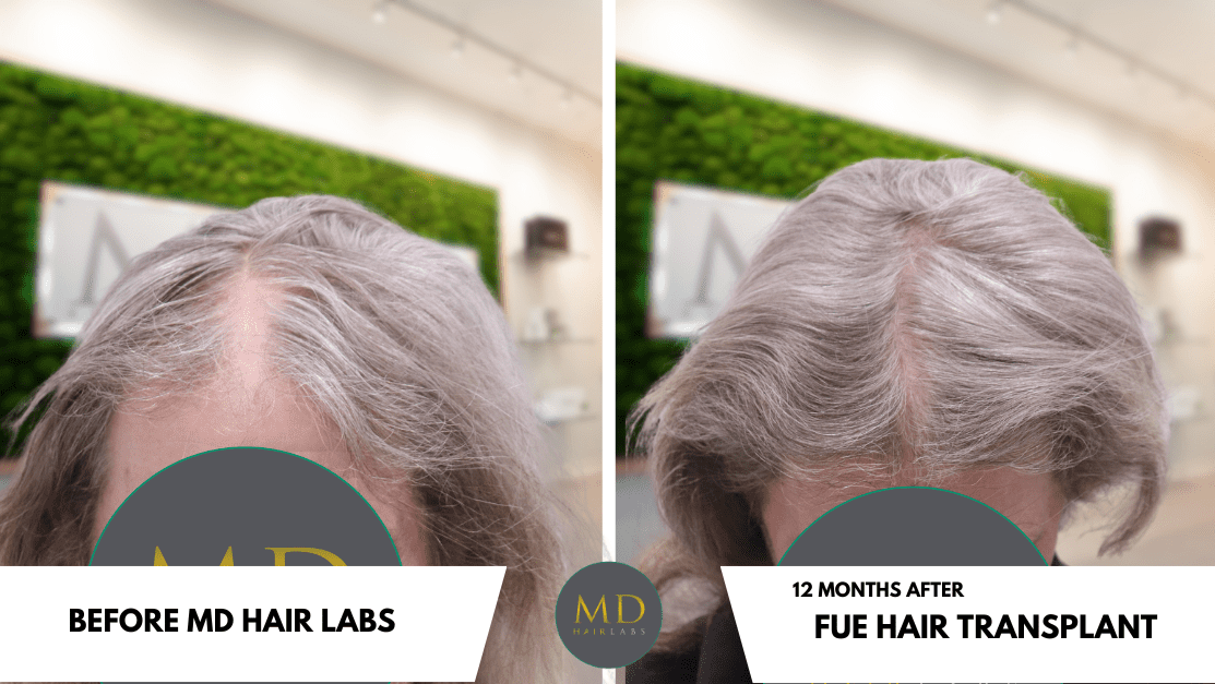 White Black Modern Photo Collage Before After Youtube Thumbnail (Carousel Facebook Ad) (1)
